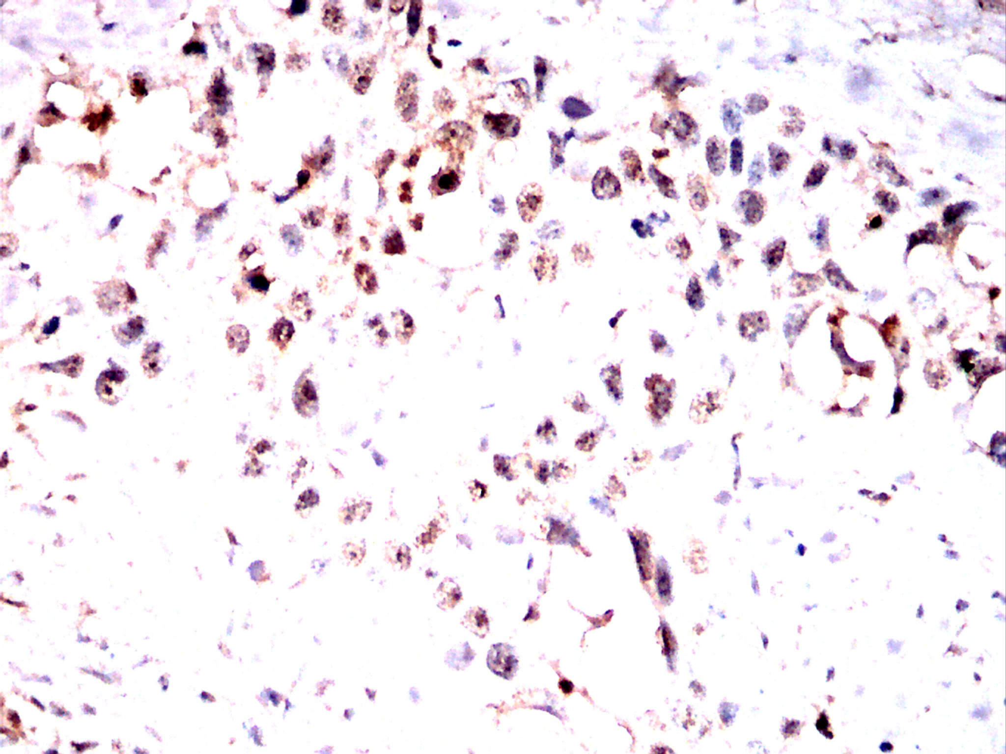 IHC 